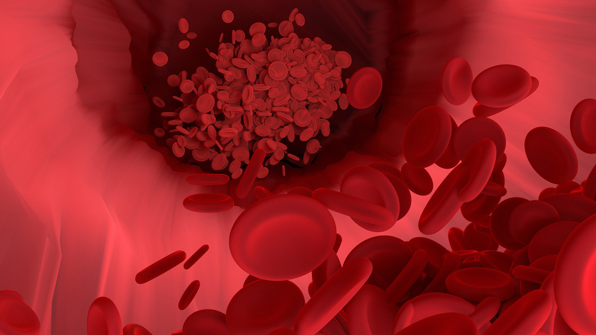 Rote Blutkörperchen in Vene